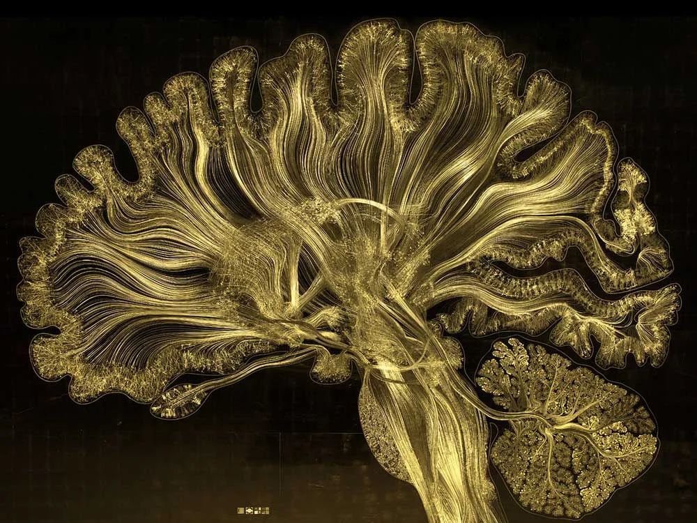 gold-leaf-prints-of-the-human-brain-by-greg-dunn-1.jpg