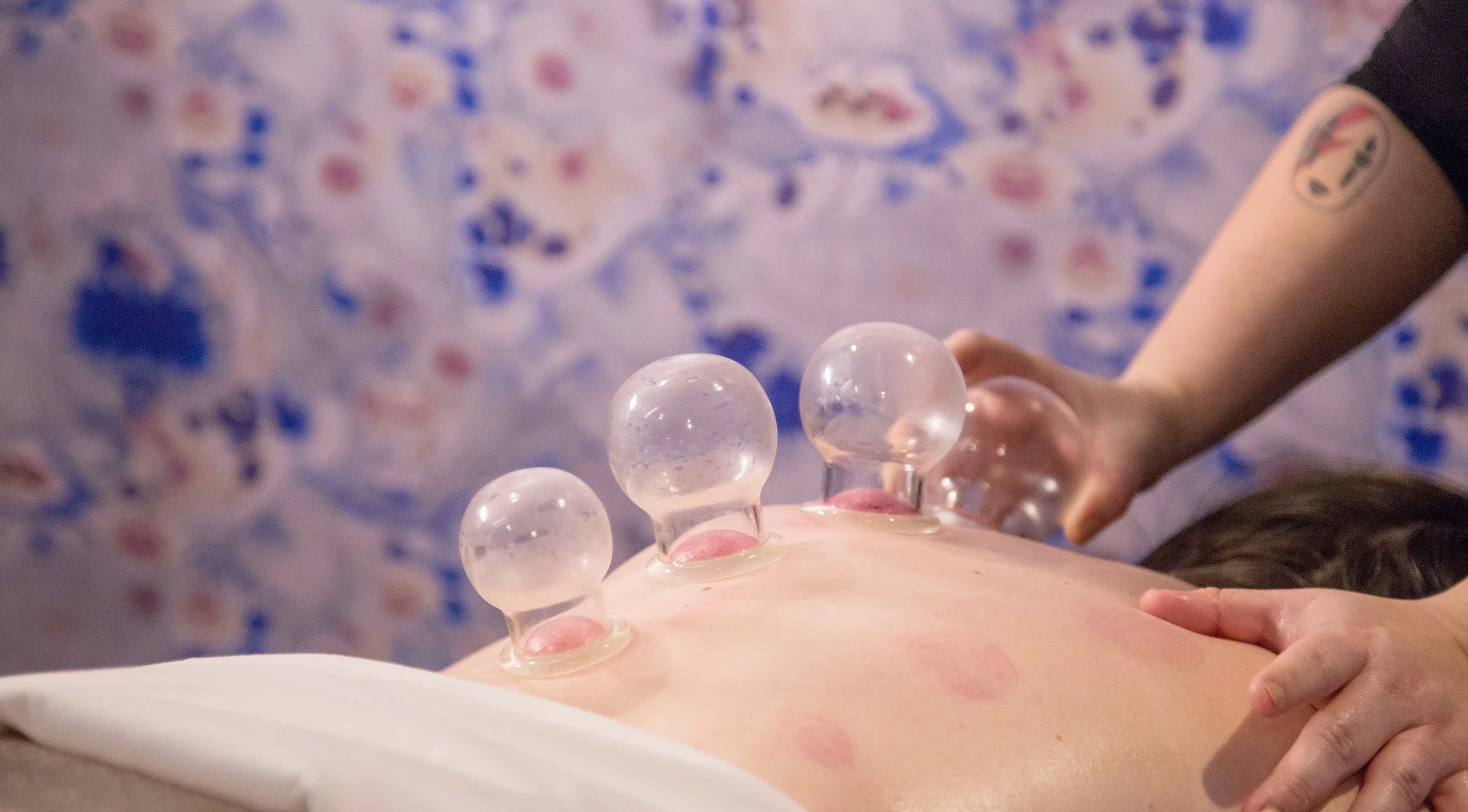 CUPPING Great for reducing pain and inflammation, Cupping is an ancient form of alternative medicine. The suction created by the cups stretches the fascia to reduce tissue restrictions. Full Body Cupping with a Massage 90-minute session: $100 Massage Cupping 60-minute session: $85 Add-On Back and Neck Cupping (Thai massage or Ashiatsu massage) 30-minute session: $45