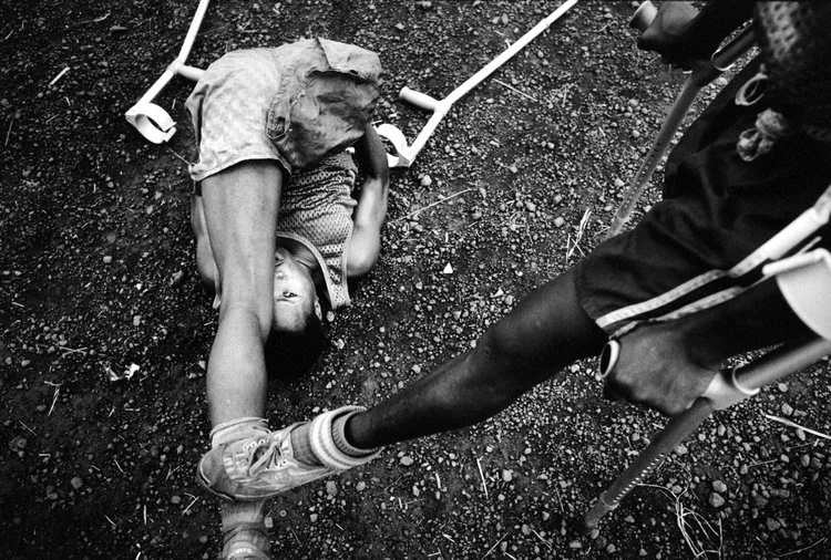 Sierra Leone, Freetown, June 2002. Amputees football field at the MSF camp stretching before the match.