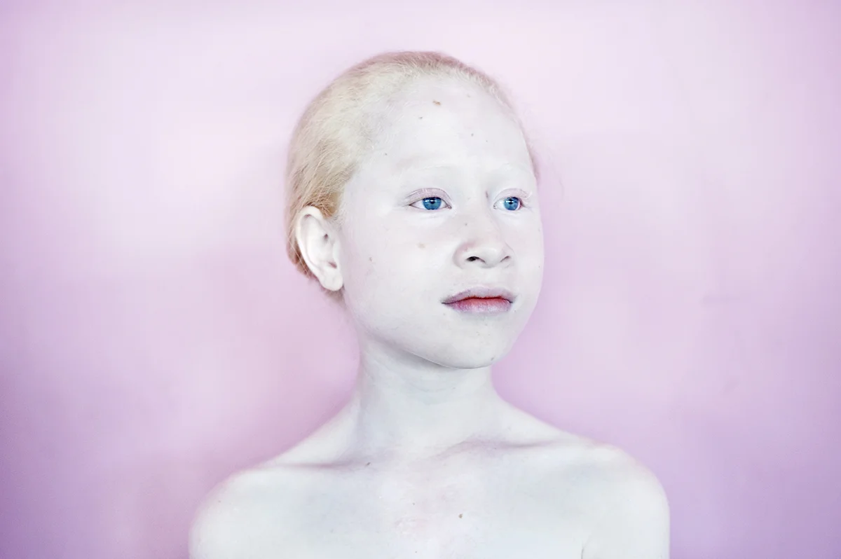 March 2013, Polynesië, Samoa, Apia, Kekea is the Samoan word for Albino.