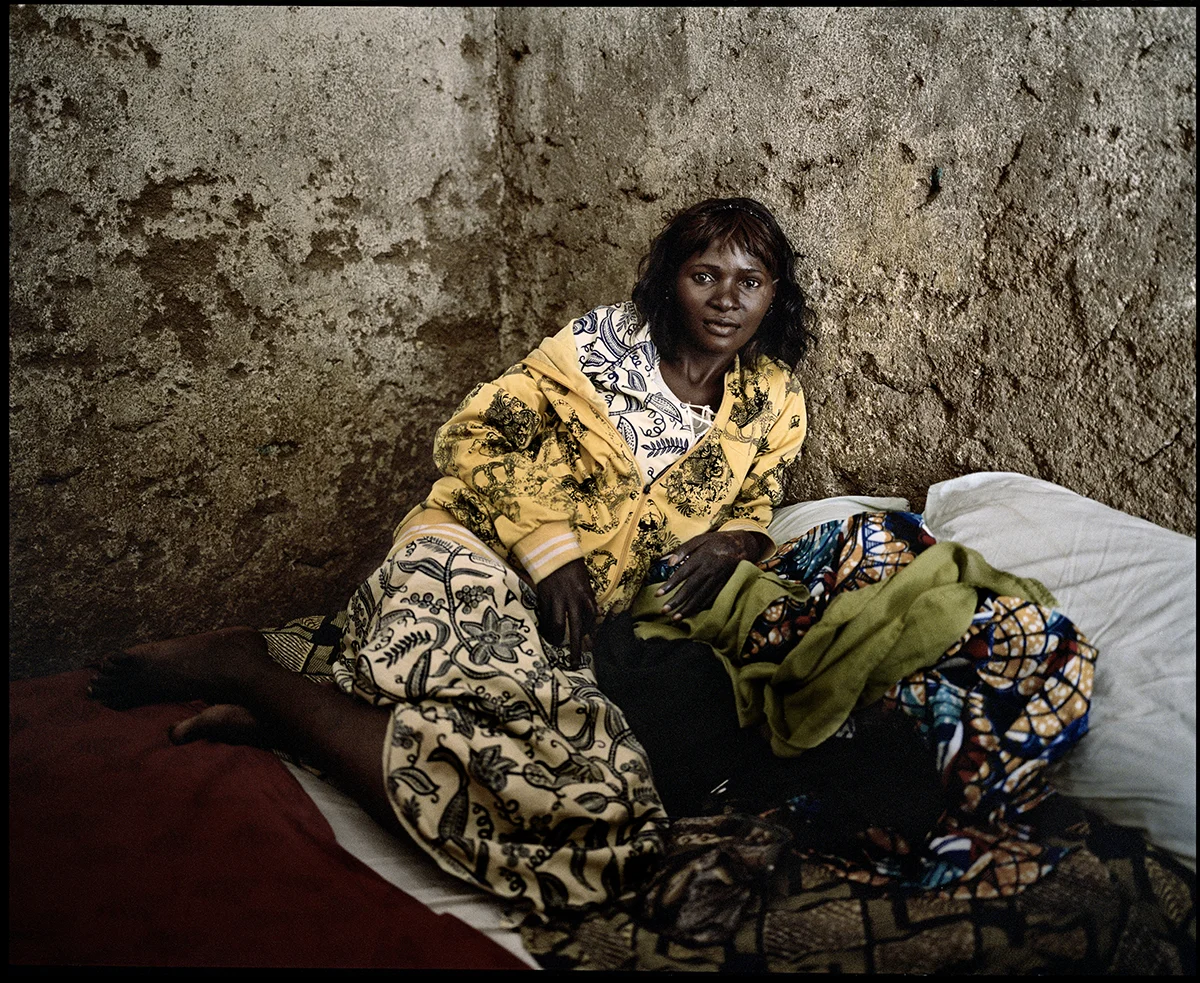 Nigeria, Dogo Nahawa, December 2011, Lydia Patrick, 25 years old, has been attacked with her village at night, in March 2010. She tried to protect her face with her hands, which have been cut. The attack was perpetrated by nomad pastoral Fulanis.