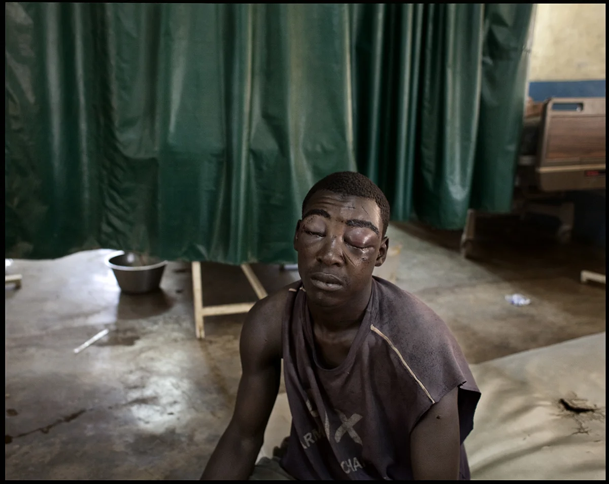Nigeria, Kaduna, April 2011, After being seriously beaten up during post-electoral violence in April 2011, this young man awaits receiving care in the emergency room, at Saint Gerard Hospital.
