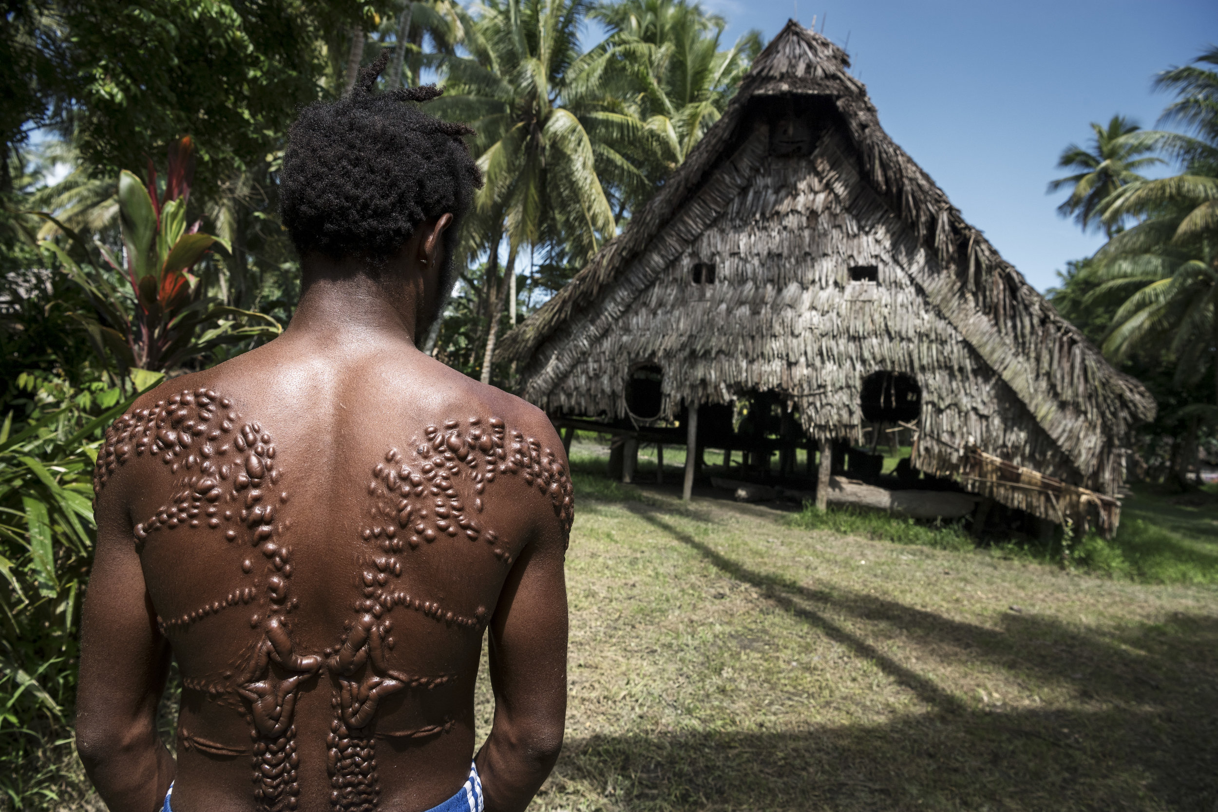  Every few years in Kandinge, Papua New Guinea a ceremony takes place where boys turn into manhood by cutting their skin and in this way simulating the pattern of a crocodile skin. 