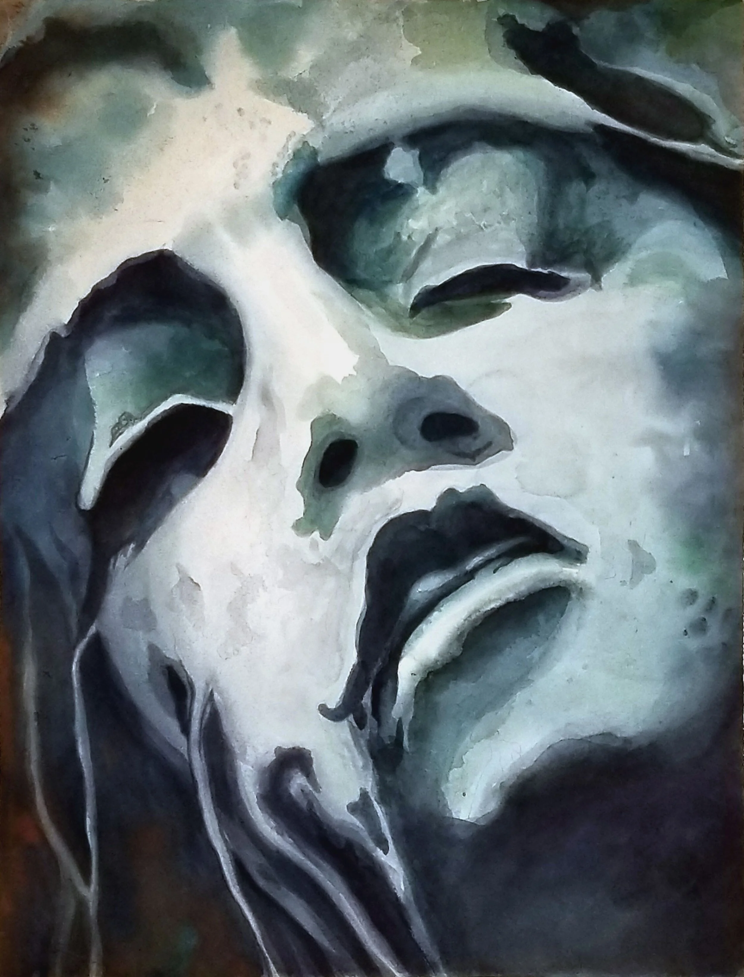 Douleur	