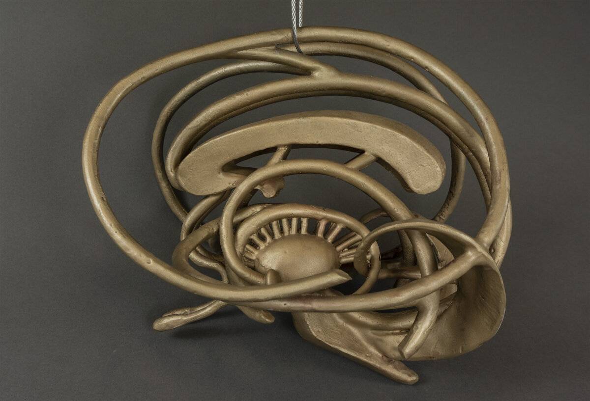 7_Adams_Alzheimer's Disease.jpg