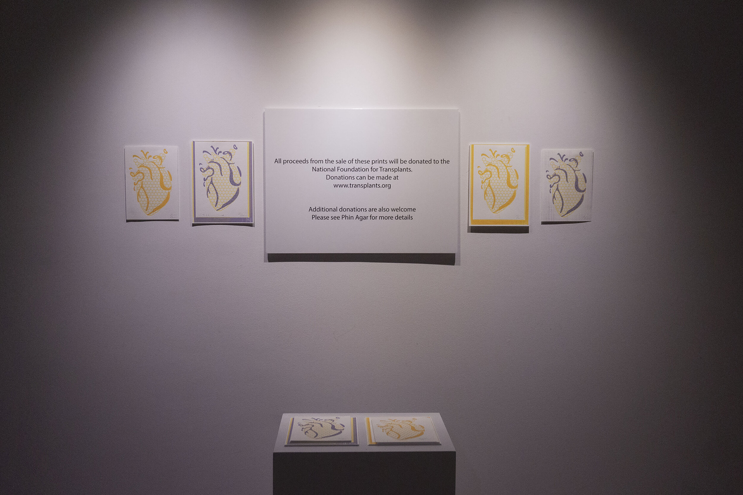 Bulbs of Dream and Dread