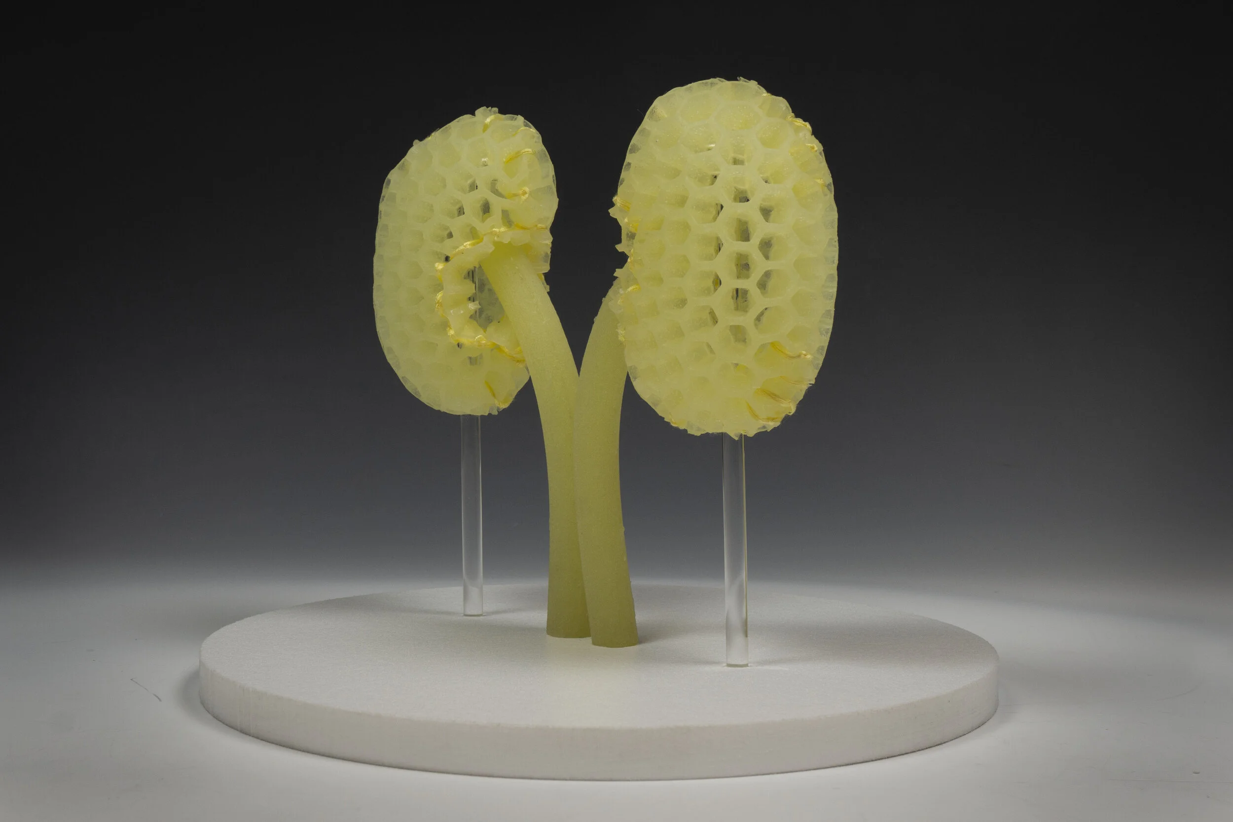 Biomimetic Sustention (Kidneys) 3.jpg