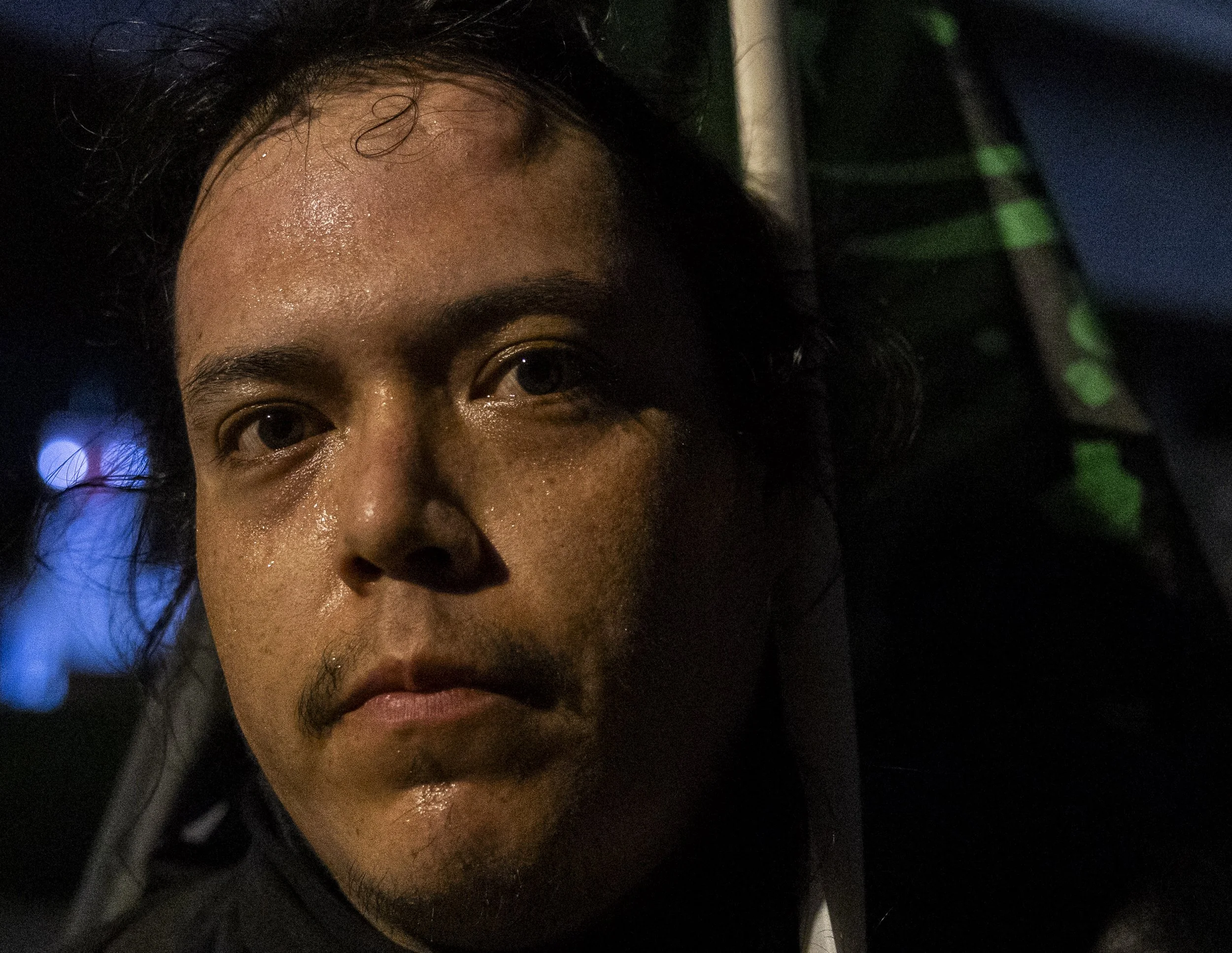 Gilbert Alba, an anti-ICE protester, posed to share a welt on his head across the street from the Metropolitan Detention Center in Los Angeles, Calif., on Monday, Sept. 1, 2025, after an Immigration and Customs Enforcement Special Response Team and