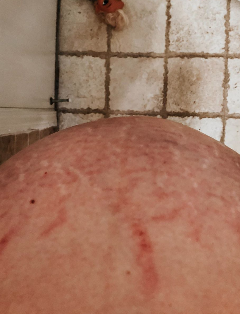 My Postpartum Stomach // #this_is_postpartum