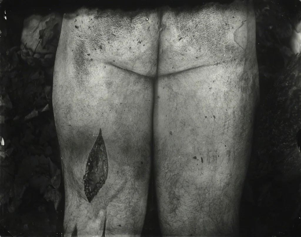 Untitled, Body Farm , 2001