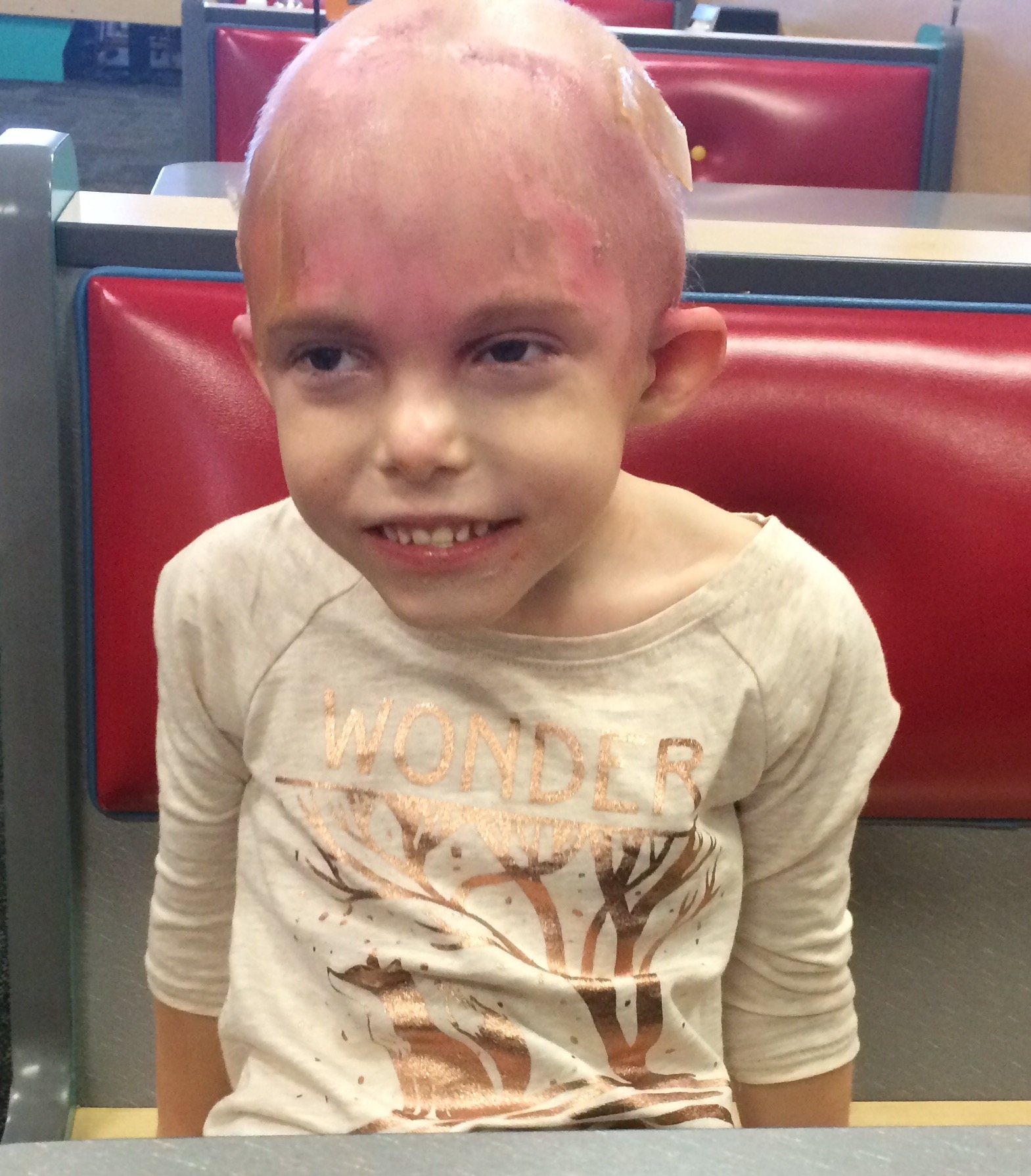 her head is swollen from the radiation head, it causes intense inflammation. Here she is, nibblin on pizza, her soft eyes weak and heavy from radiation affecting her ocular functions, yet still smilin....