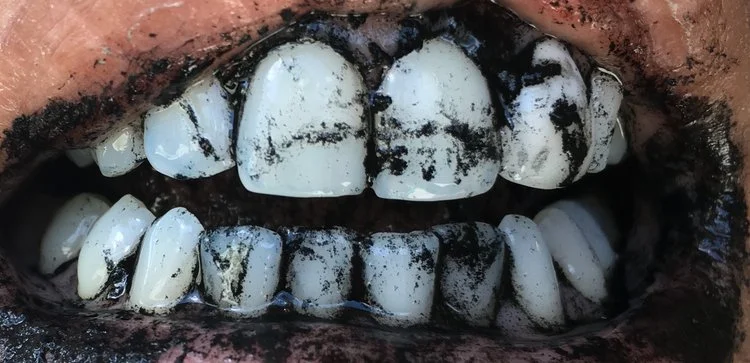 Natural Whitening, with Activated Charcoal Tooth Powder