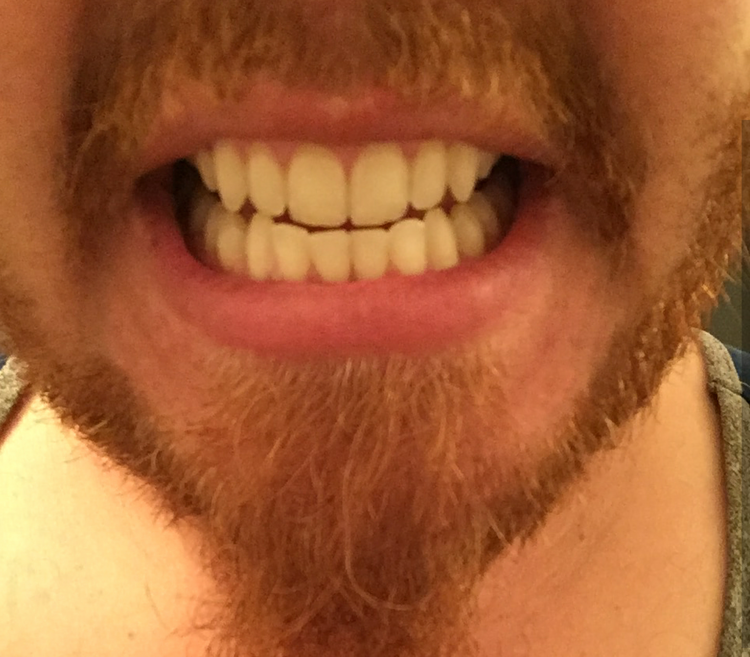 Tooth PowderBEfore.png