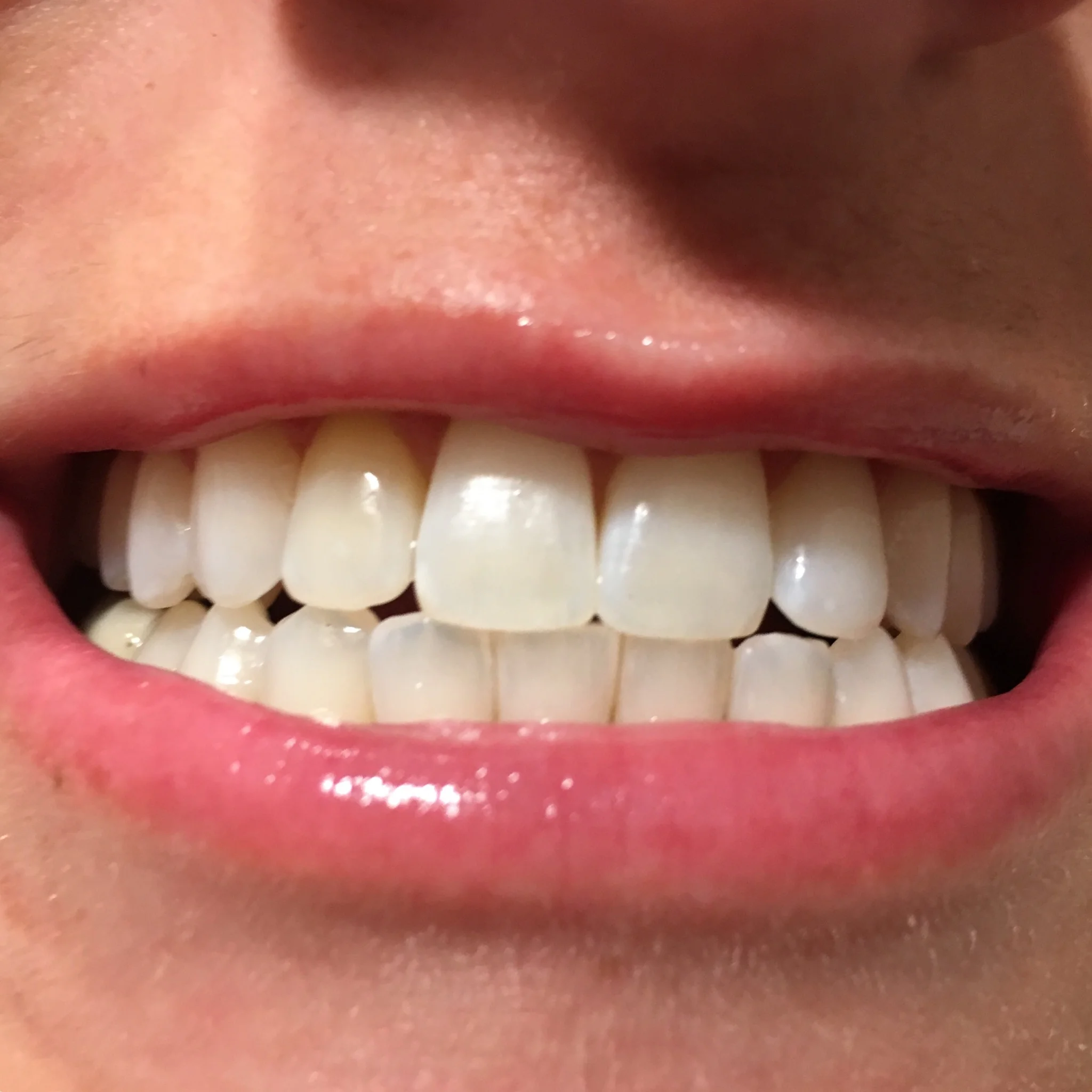 afterteeth.jpg