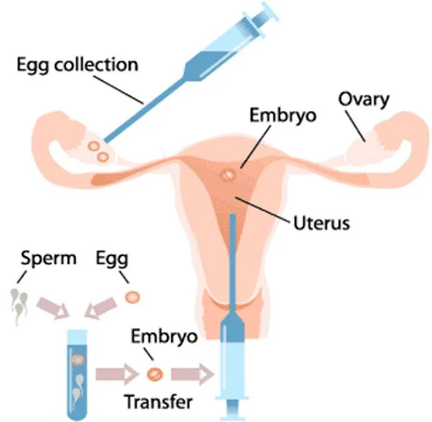 Figure 2 – When the women is injected with the combination of sperm and egg.