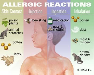Figure 2 – Common allergy triggers.