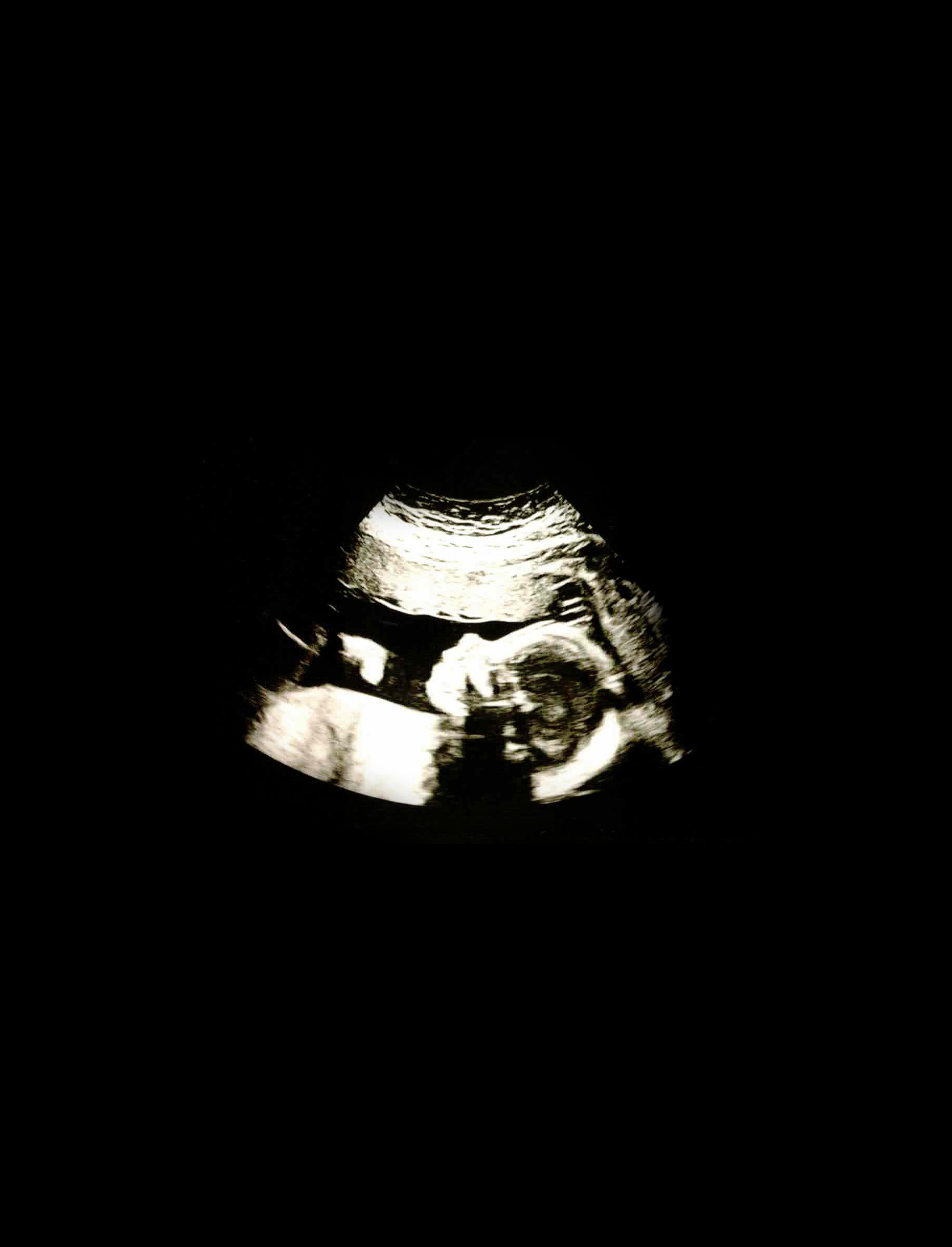 moc-5-ultrasound-2.jpg