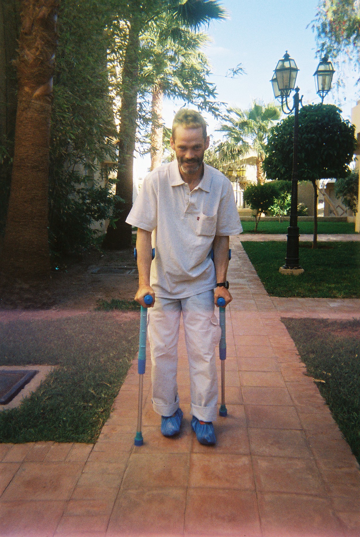 Mistake: On crutches after injuring feet