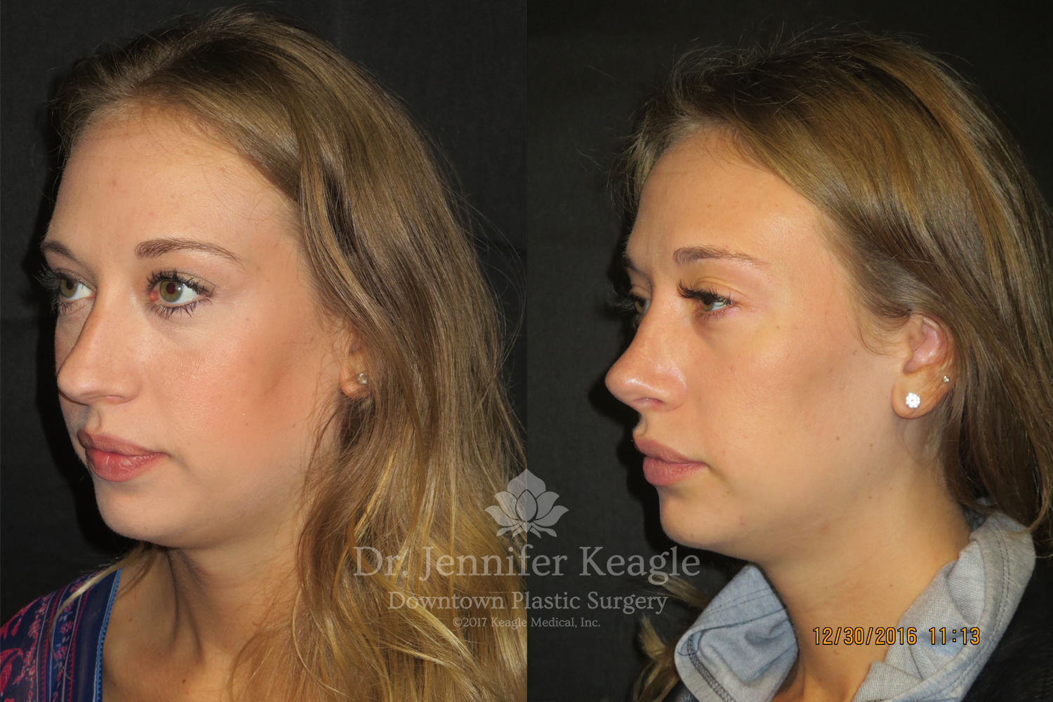 Dr-Jennifer-Keagle-Downtown-LA-Plastic-Surgery-IMG_8954