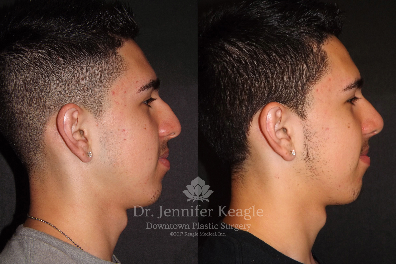 Dr-Jennifer-Keagle-Downtown-LA-Plastic-Surgery-IMG_8954