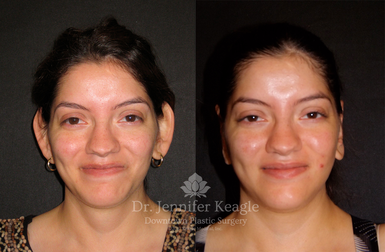 Dr-Jennifer-Keagle-Downtown-LA-Plastic-Surgery-IMG_8954