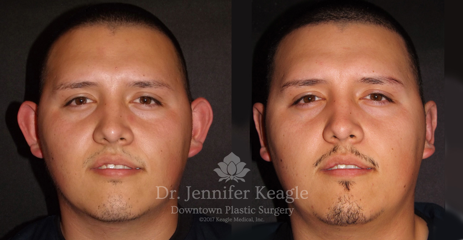 Dr-Jennifer-Keagle-Downtown-LA-Plastic-Surgery-IMG_8954