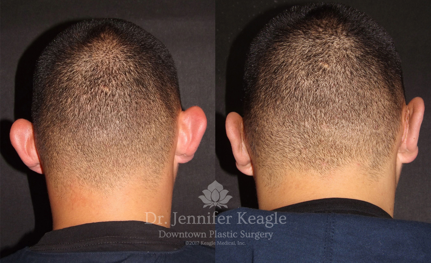 Dr-Jennifer-Keagle-Downtown-LA-Plastic-Surgery-IMG_8954