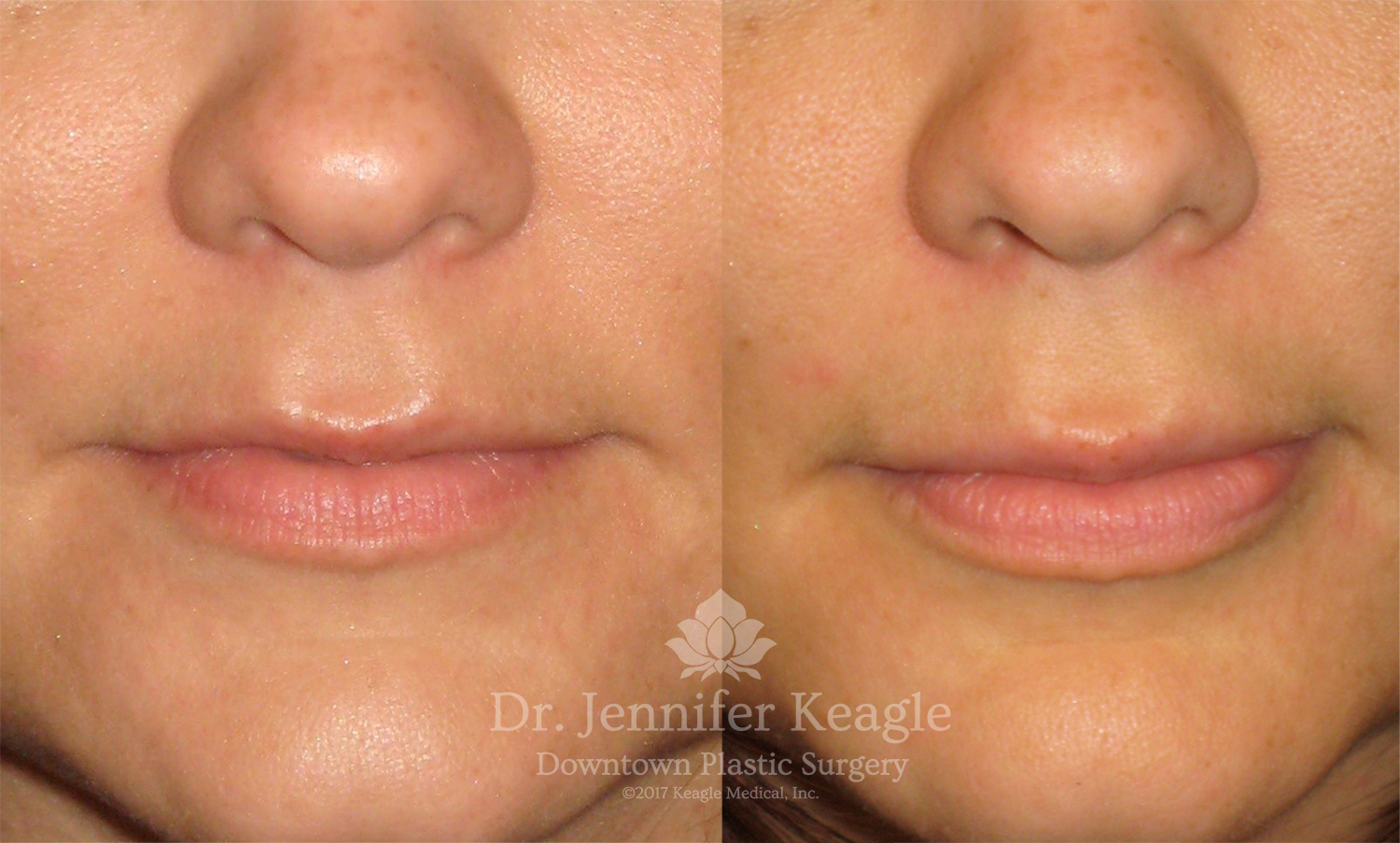 Dr-Jennifer-Keagle-Downtown-LA-Plastic-Surgery-IMG_8954