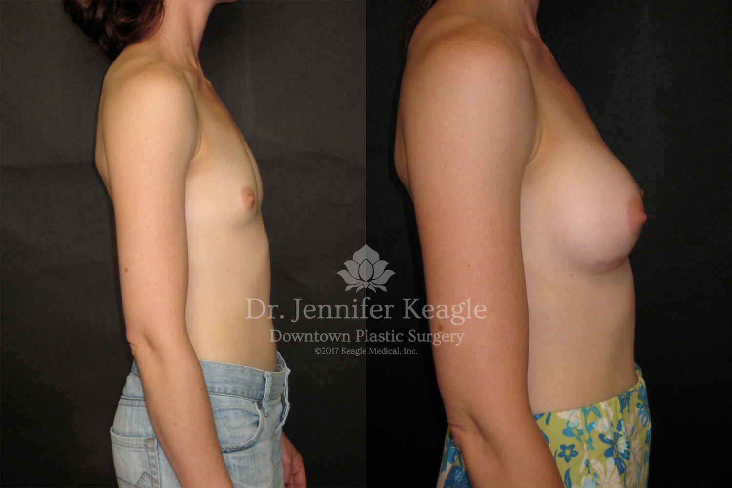 Dr-Jennifer-Keagle-Downtown-LA-Plastic-Surgery-IMG_8954