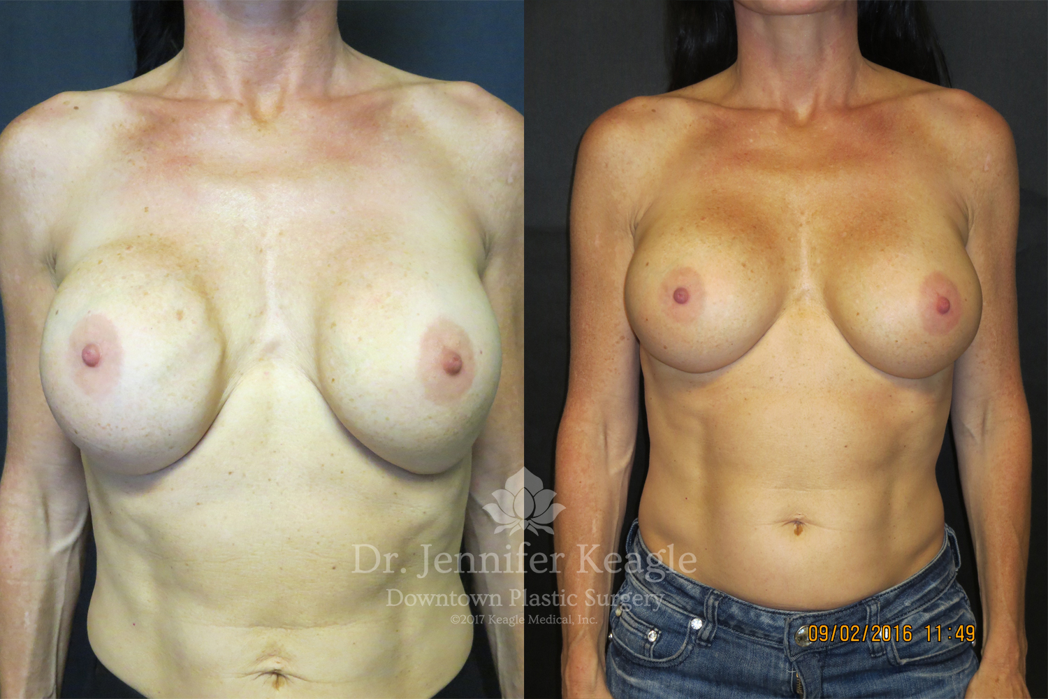 Dr-Jennifer-Keagle-Downtown-LA-Plastic-Surgery-IMG_8954