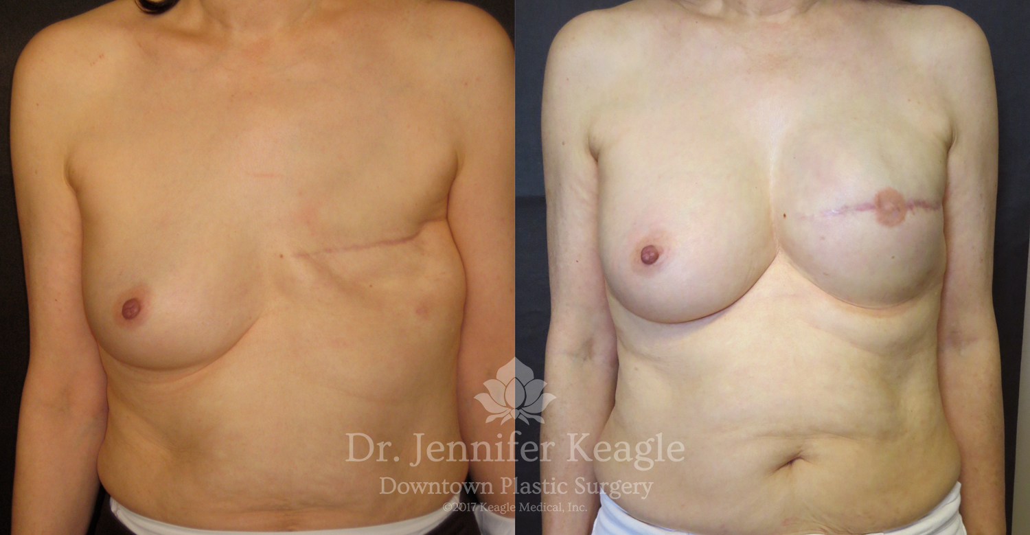 Dr-Jennifer-Keagle-Downtown-LA-Plastic-Surgery-IMG_8954