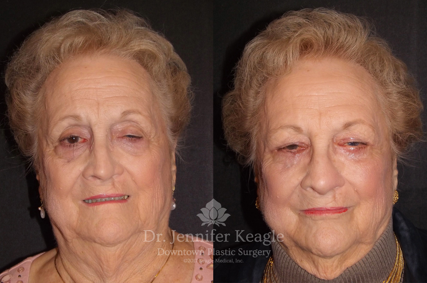 Dr-Jennifer-Keagle-Downtown-LA-Plastic-Surgery-IMG_8954