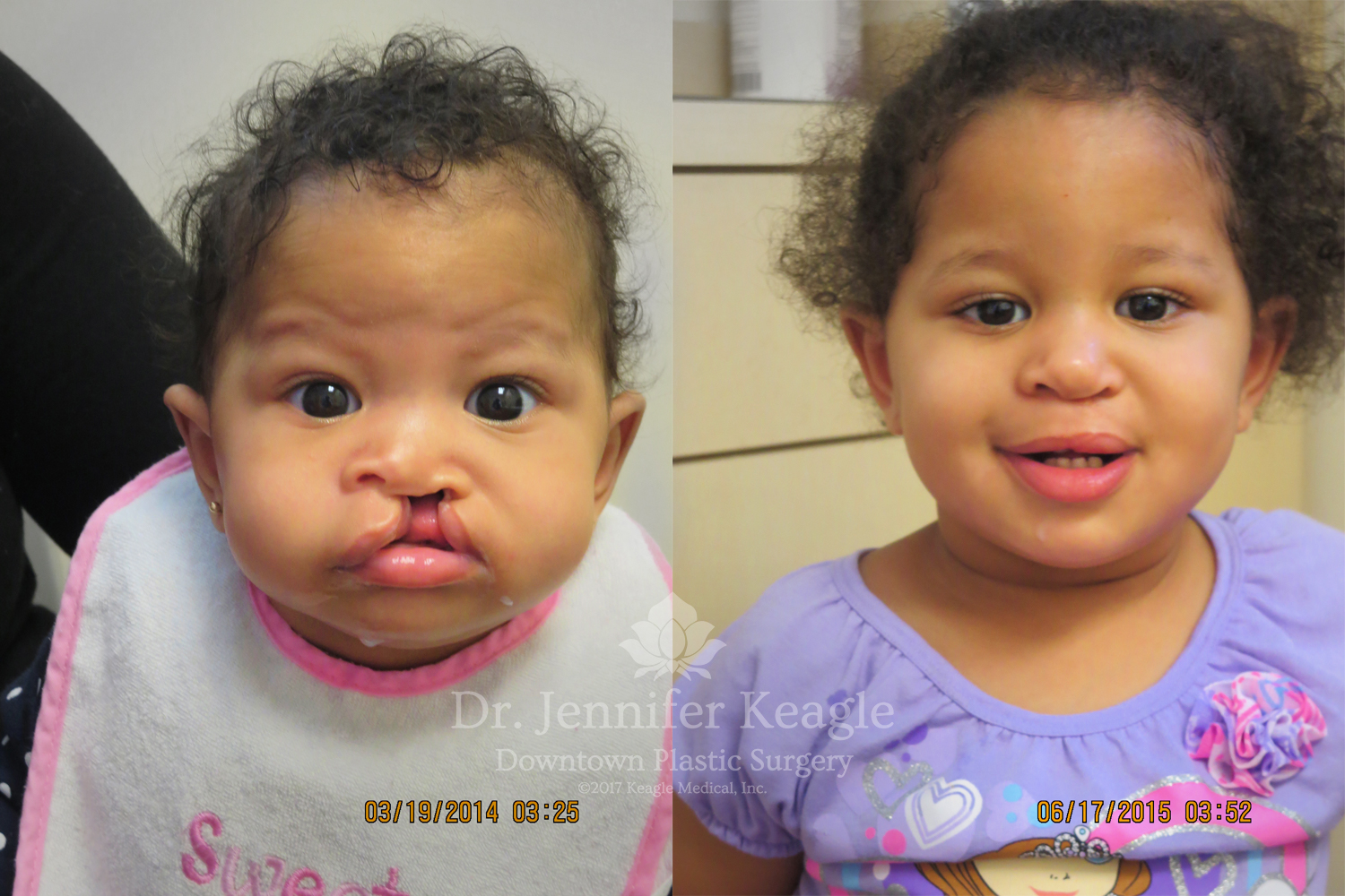 Dr-Jennifer-Keagle-Downtown-LA-Plastic-Surgery-IMG_8954