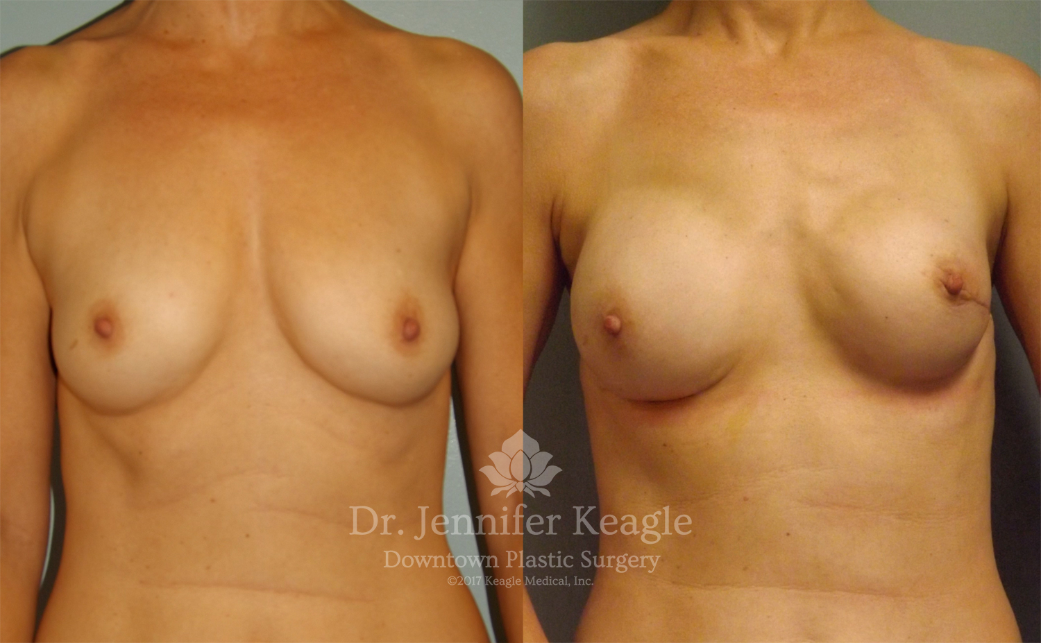 Dr-Jennifer-Keagle-Downtown-LA-Plastic-Surgery-IMG_8954