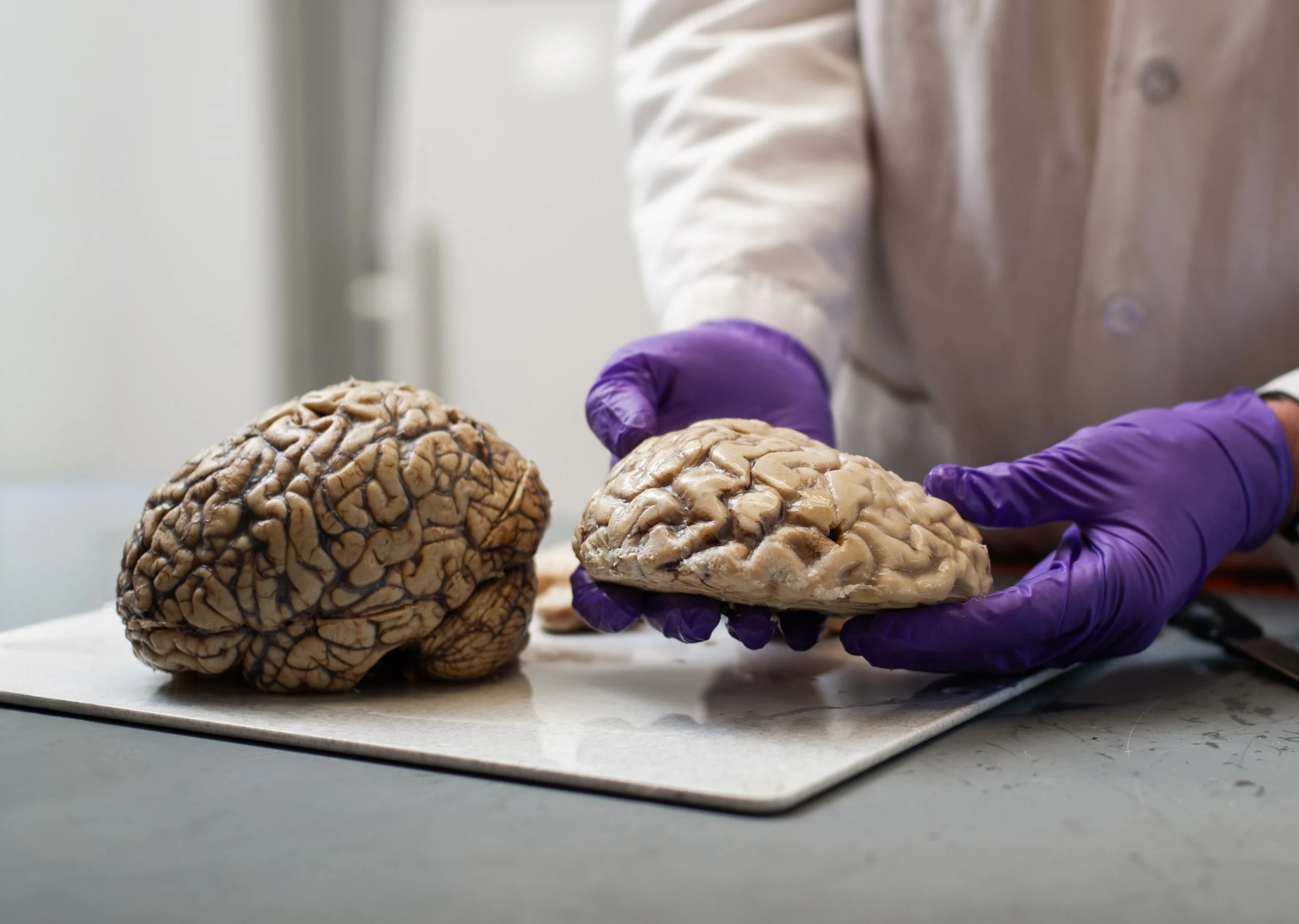 Human Brain