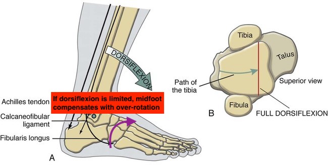 DF restriction midfoot compensation.jpg