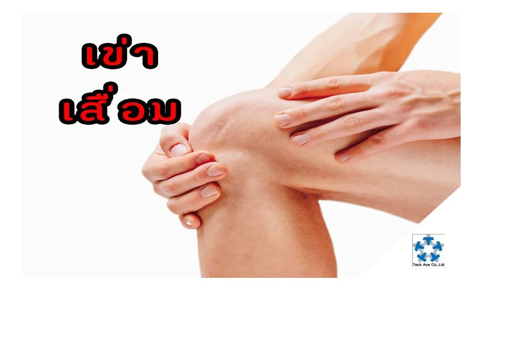 เข่าเสื่อมเป็นโรคที่พบได้บ่อย ในคนสูงอายุและคนอ้วน มักจะเป็นเรื้อรังตลอดชีวิต แต่ไม่มีอันตรายร้ายแรง นอกจากอาการปวดทรมาน เดินไม่ถนัด ขาโก่ง เข่าทรุด อันตรายร้ายแรงมักเกิดจากการใช้ยาอย่างผิดๆ ดังนั้น จึงต้องเรียนรู้วิธีอยู่กับโรคนี้อย่างมีความสุขและปลอดภัย สาเหตุ เกิดจากการเสื่อมชำรุดหรือการสึกหรอ ของข้อเข่า ซึ่งเป็นผลมาจากการใช้งานมาก การบาดเจ็บ หรือมีแรงกระทบกระแทกต่อข้อมาก (เช่น น้ำหนักมาก เล่นกีฬาหนักๆ) ทำให้กระดูกอ่อนที่บุอยู่ตรงบริเวณผิวข้อต่อสึกหรอ และเกิดกระบวนการซ่อมแซม ทำให้มีปุ่มกระดูกงอกรอบๆ ข้อต่อ ปุ่มกระดูกที่งอกบางส่วน จะหักหลุดเข้าไปในข้อต่อ ทำให้ขัดขวางการเคลื่อนไหวของข้อต่อ และข้อต่อมีเสียงดังเวลาเคลื่อนไหว การงอเข่า เช่น นั่งยองๆ นั่งขัดสมาธิ นั่งพับเพียบ การเดินขึ้น-ลงบันได เป็นต้น จะทำให้เกิดแรง กดดันที่ข้อต่อ เป็นเหตุให้ผิวข้อเสื่อมได้เช่นกัน เมื่อข้อเข่าเสื่อม ก็จะส่งผลให้กล้ามเนื้อและเส้นเอ็นรอบๆ ข้อเข่ามีการอักเสบและอ่อนแอร่วมไปด้วย ทำให้เกิดอาการปวดเข่า เข่าอ่อน (เข่าทรุด) และเมื่อเป็นมากๆก็จะทำให้เกิดอาการขาโก่ง โรคเข่าเสื่อม จึงพบมากในคนสูงอายุ (มักพบในผู้หญิงอายุมากกว่า 55 ปีขึ้นไป) คนอ้วน คนที่เล่นกีฬาที่มีการกระแทกของข้อเข่ารุนแรง คนที่ชอบนั่งงอเข่า หรือต้องเดินขึ้น-ลงบันไดบ่อย อาการ ผู้ที่มีข้อเข่าเสื่อมอาจมีอาการผิดปกติที่เข่าข้างเดียว หรือ 2 ข้างก็ได้ อาการที่พบบ่อย ก็คือ อาการปวดเวลาเคลื่อน-ไหวข้อเข่า จะลุกจะนั่งจะรู้สึกขัดยอกในข้อเข่า โดยเฉพาะอย่างยิ่งเวลาเดินขึ้น-ลงบันได หรือเวลานั่งงอเข่านานๆ เวลาขยับ หรือเคลื่อนไหวข้อเข่า จะมีเสียงดังกรอบแกรบในข้อเข่า มักจะเกิดจากการเสียดสีของผิวข้อต่อที่ขรุขระ และจะมีการสะดุด หรือติดขัดในข้อ เนื่องจากเศษกระดูกงอกหักหลุดเข้าไปขัดขวางในข้อต่อ ผู้ที่มีกล้ามเนื้อรอบๆเข่าอ่อนแรง ก็จะมีอาการเข่าอ่อน เข่าทรุด บางครั้งอาจทำให้เกิดการพลัดตกหกล้มได้ เมื่อเข่าเสื่อมรุนแรง ผู้ป่วยจะมีอาการขาโก่ง เดินไม่ถนัด เดินคล้ายขาสั้นข้างยาวข้าง (ลงน้ำหนักไม่เต็มที่ หรือเอนตัวเพราะเจ็บเข่าข้างหนึ่ง) บางคนเดินกะเผลกหรือโยนตัวเอนไปมา บางคนอาจงอเหยียดเข่าลำบาก หรือกล้ามเนื้อขาลีบลง ในรายที่มีข้อเข่าอักเสบมาก นอกจากปวดเข่า รุนแรงแล้ว ยังมีอาการบวมของข้อเข่าร่วมด้วย อันเนื่องมาจาก ข้อมีการผลิตน้ำในข้อมากขึ้นกว่าปกติ