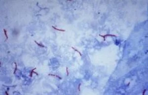 mycobacteria on acid-fast stain