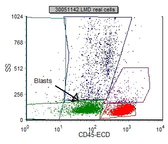 Acute Myelogenous Leukemia