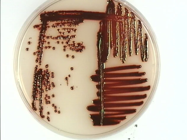 Serratia marcescens