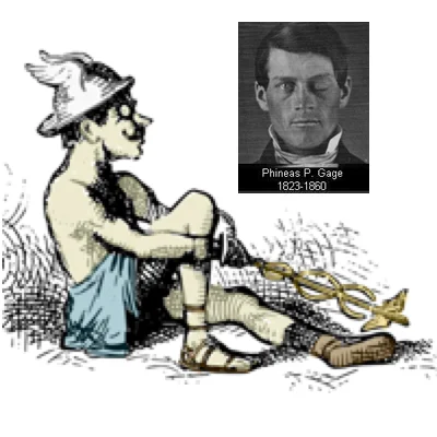 SqXprntIcon_gage.jpg
