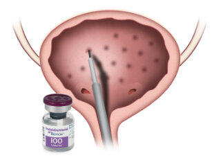 Feb. 24 webinar to address decreasing bladder spasticity in SCI with Botox injections — Northern California Spinal Cord Network