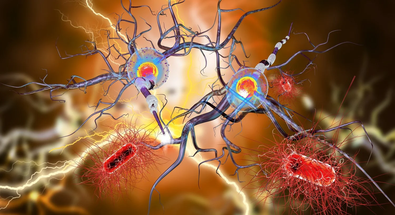 Artist's rendering of nerve cells - Autoimmune Disorders Treatment at Sunrise Wellness Center. #ImmuneWarrior