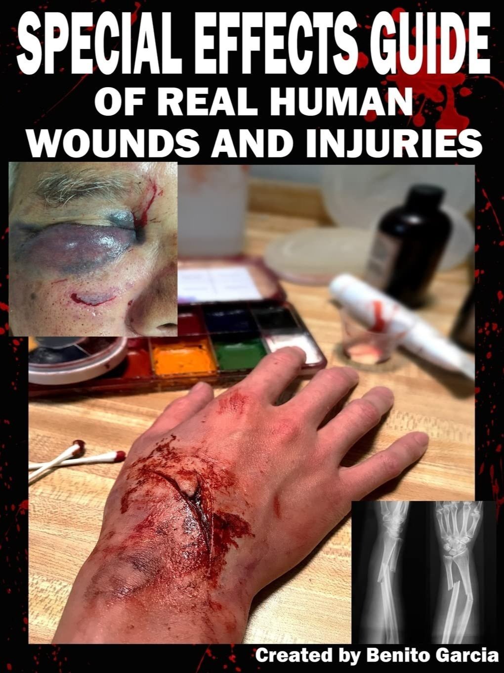 Special Effects Guide Of Real Human Wounds and Injuries
