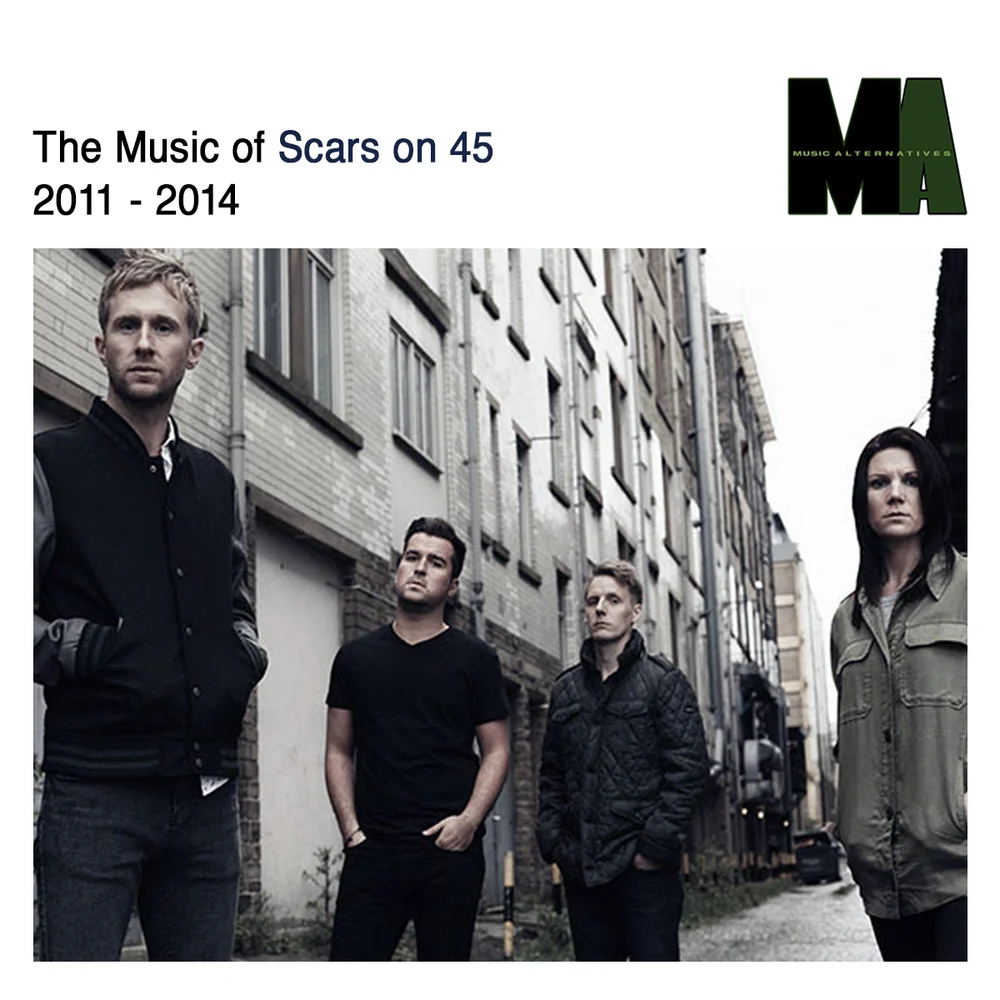 Scars On 45 Music Alternatives