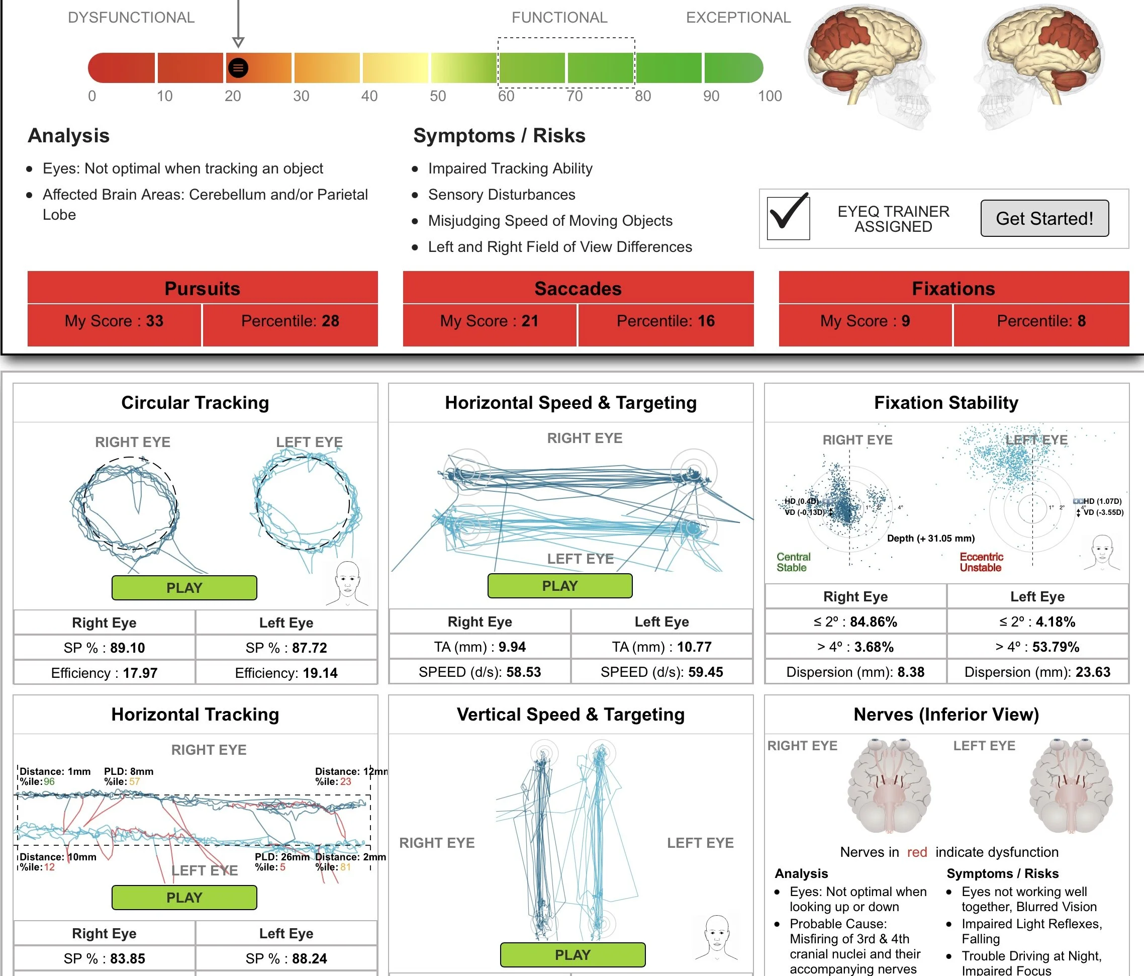 A client came to us after continuously rolling their ankles whilst out running. A prime example of why we treat the source, not just the symptoms!