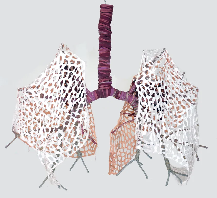 Lungs Pneumonoultramicroscopicsilicovolcanoconiosis