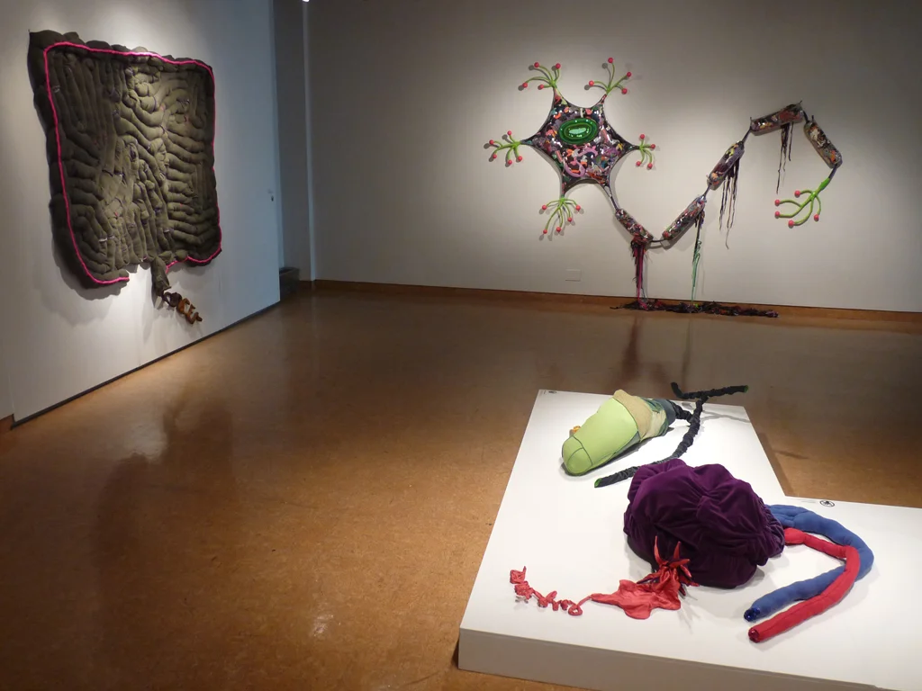 ColonCancer (left wall), NeuronMS (back wall), GallBladderStones and SpleenRupture (on low plinth)