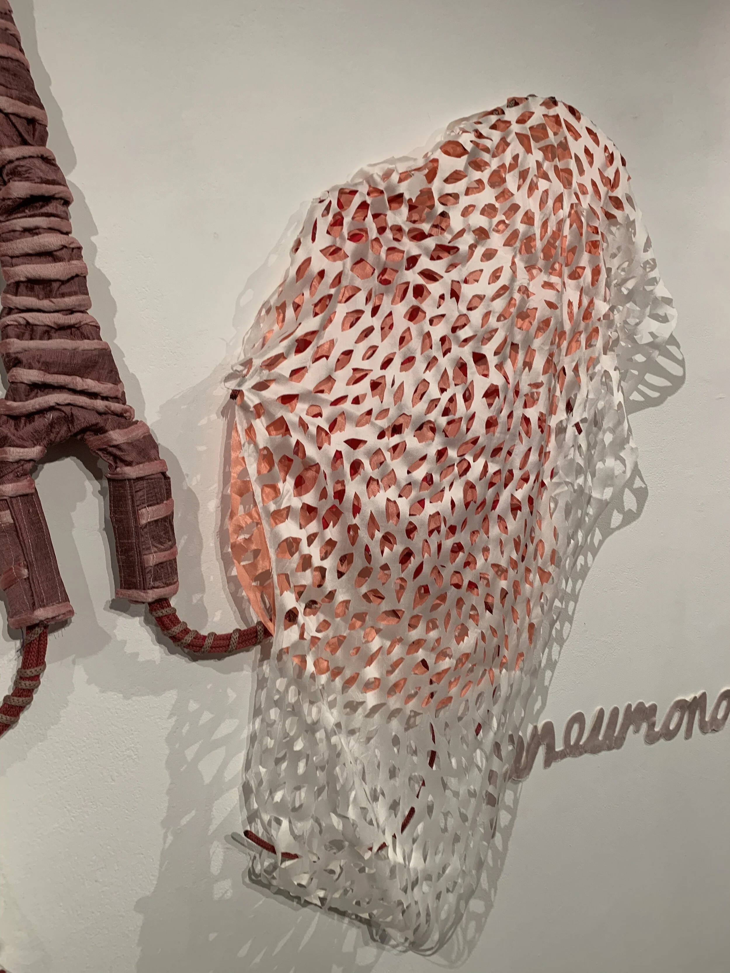 Detail, LungsPneumonoultramicroscopicsilicovolcanoconiosis, 2011