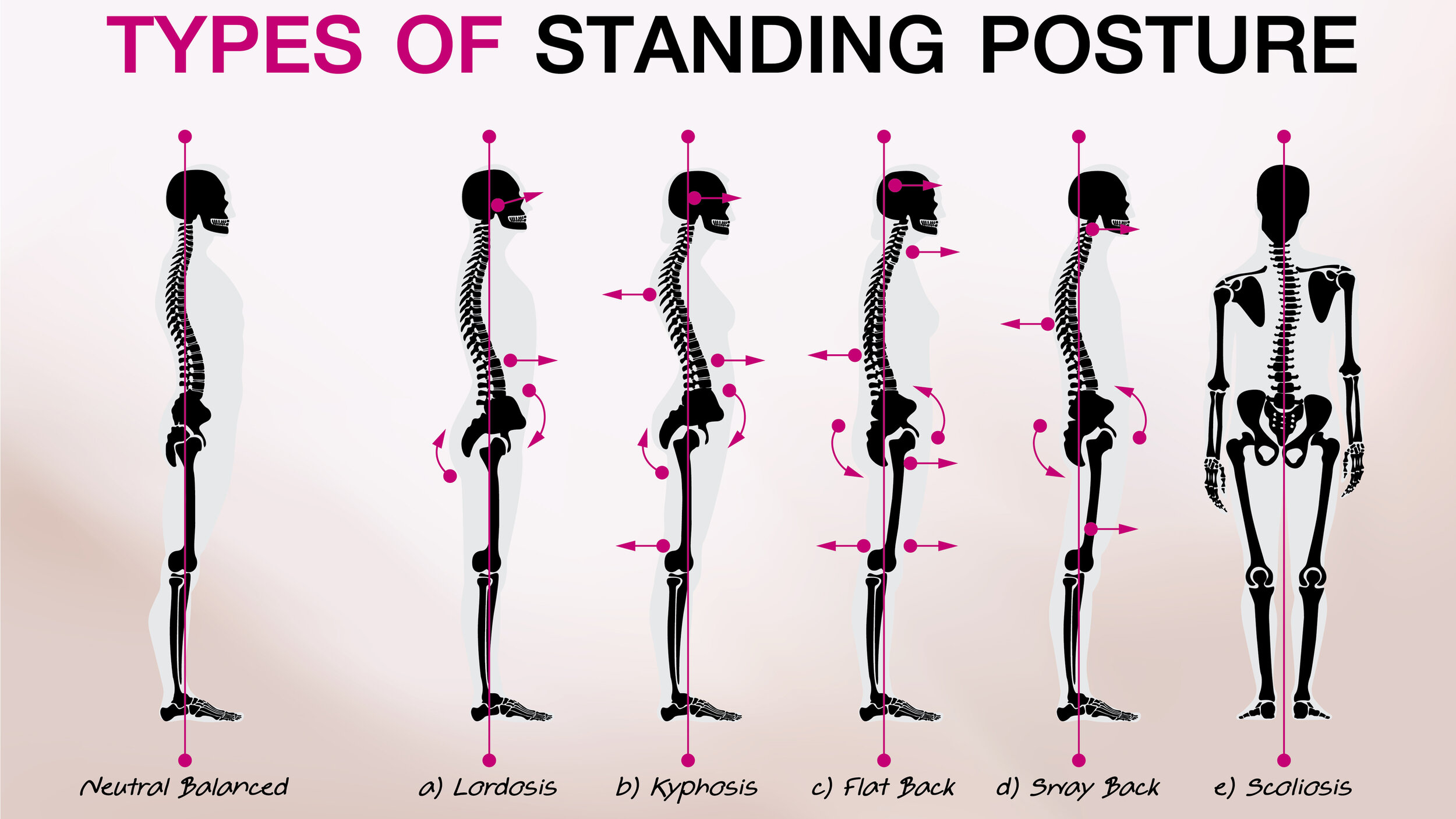 Stand Up Straight! Why Good Posture Matters